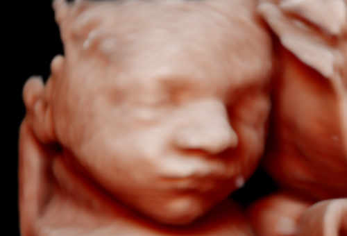 3D-Baby-Bump-Ultrasound-REAL-D-HD-LIVE